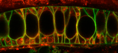 This image of fluid-filled sacs forming a fish notochord was on the cover of a journal.