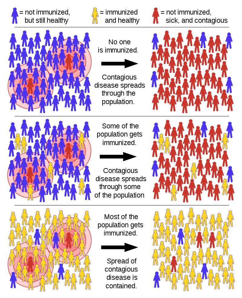 File:Breast quadrants.svg - Wikimedia Commons